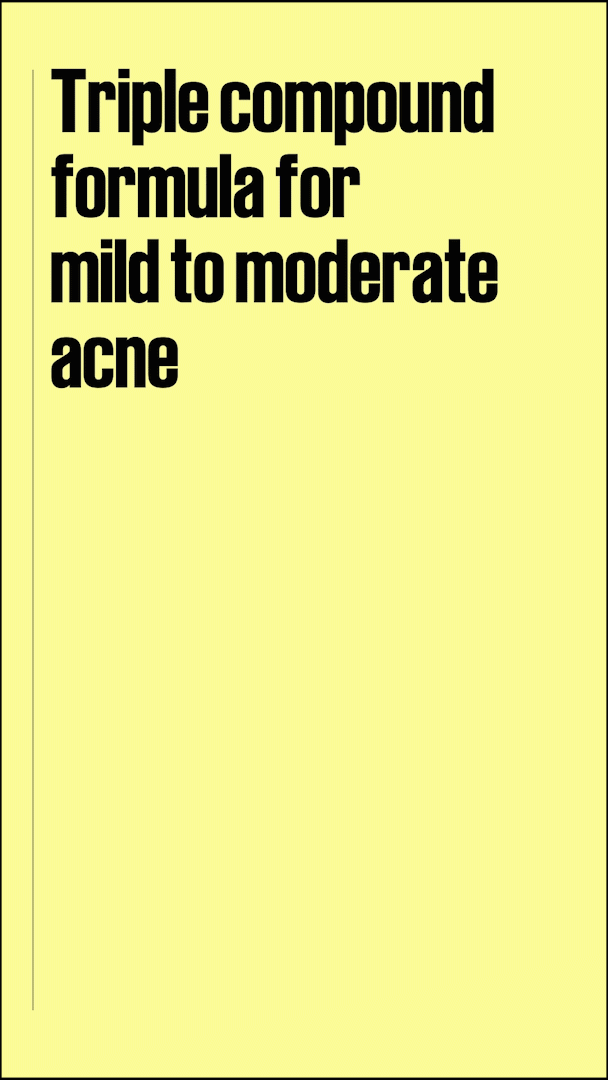 Story — Triple compound formula for mild to moderate acne
