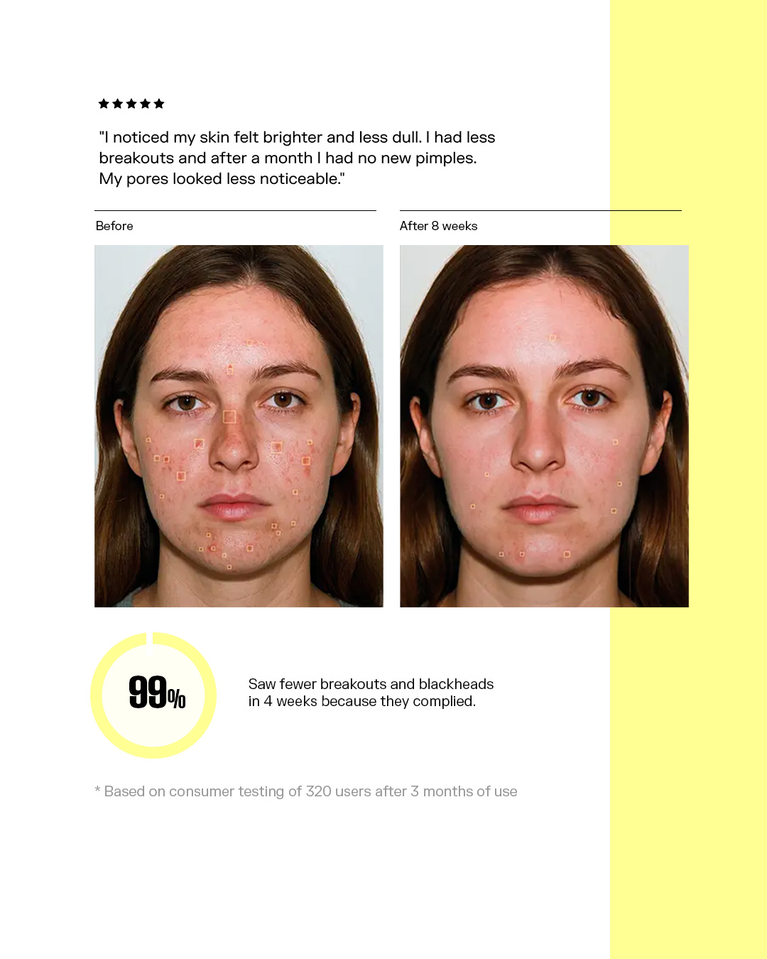 Before and after 8 weeks — 99% saw fewer breakouts